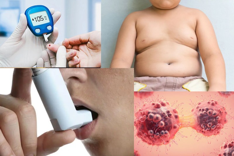 Treatment of obesity