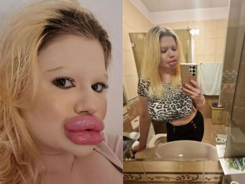 world_woman_biggest_lips_andrea_ivanvoa.jpg