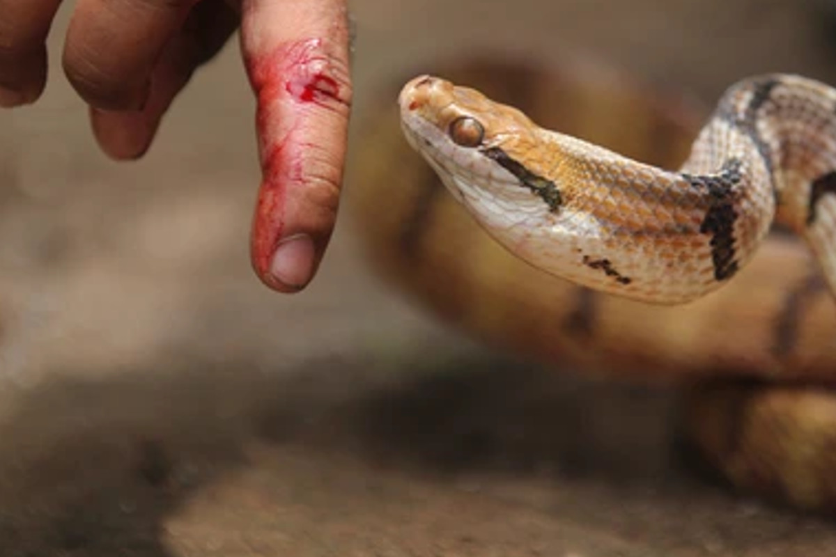 snake_bites.jpg