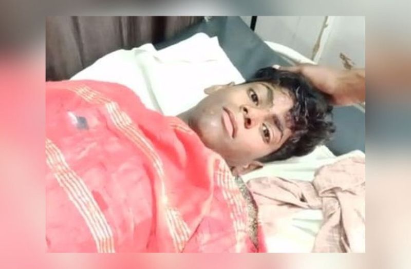 condition_of_17-year-old_child_is_critical.jpg