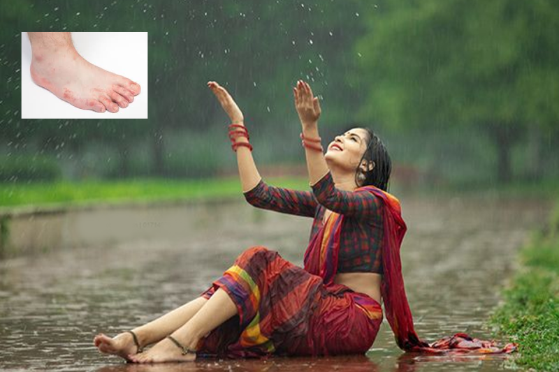feet_fungal_infection_in_monsoon.png