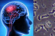brain_eating_amoeba.jpg