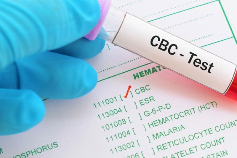 cbc-test.jpg