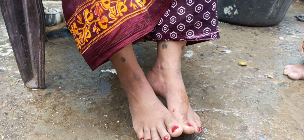 Amazing : महिला के लिए जानी दुश्मन बने सांप