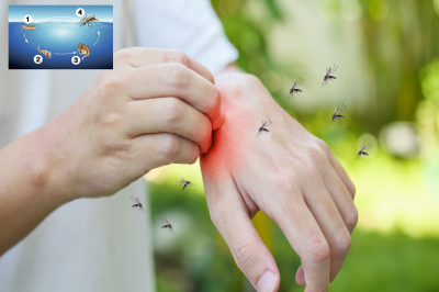 dengue_fever_causes_symptoms.png