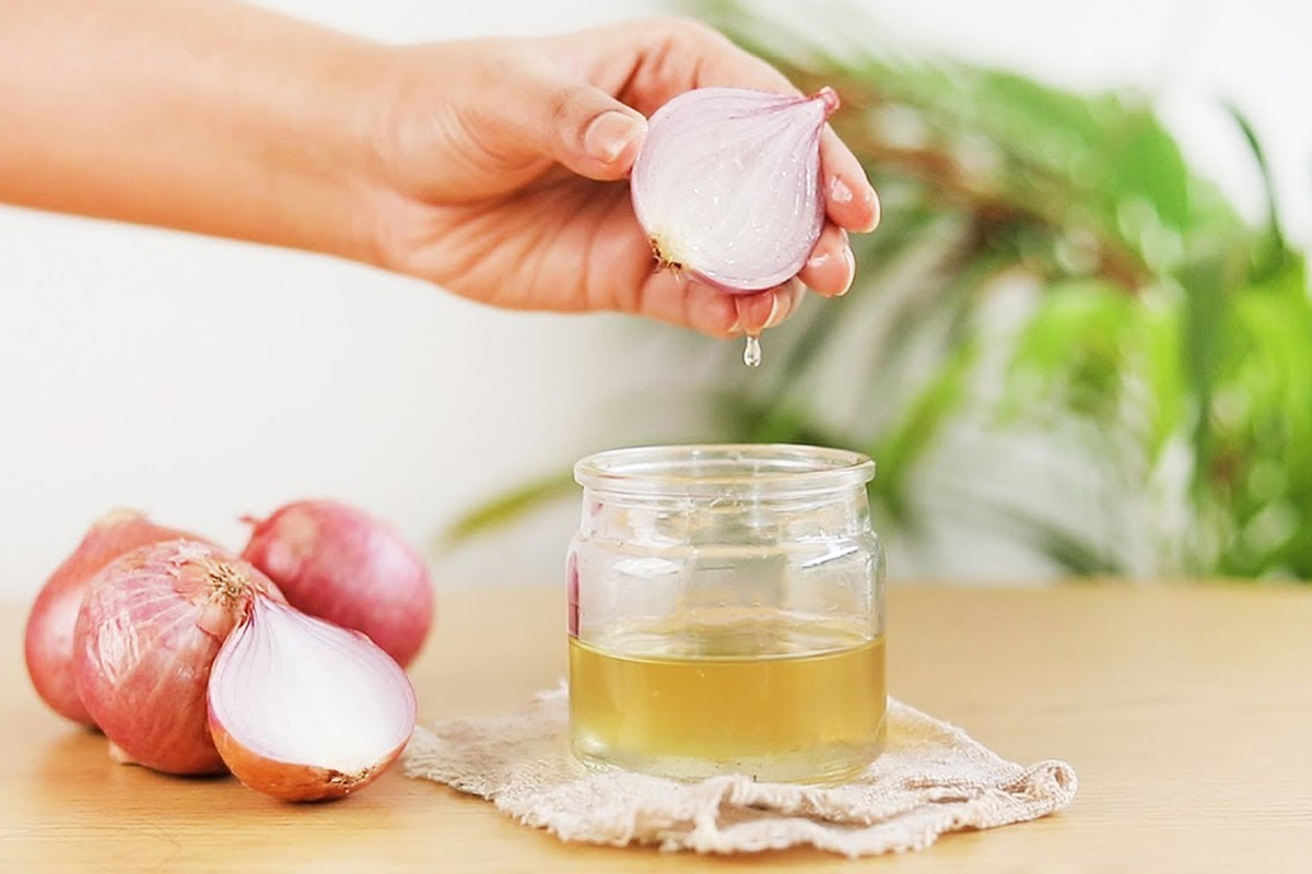 Onion Juice Benefits बालों में प्याज का रस लगाने से दूर होती है कई