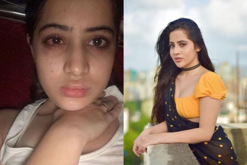 Uorfi Javed Lip Fillers: ऊर्फी जावेद अपने आउट्फिट्स के लिए तो हमेशा सुर्खियों में रहती हैं, लेकिन इस बार उर्फी ने अपनी दर्द भरी कहानी शेयर की है।