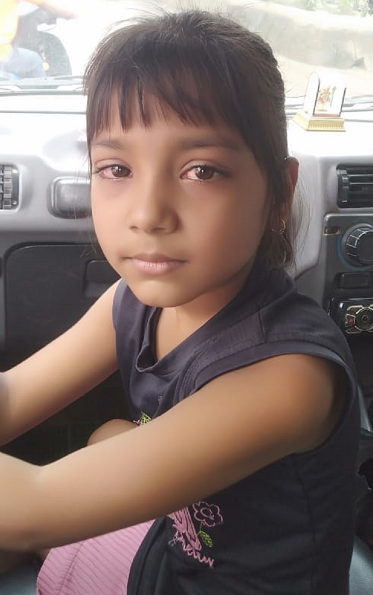 उमस व नमी से लाल हो रही आंखों, बढ़ रहे आई फ्लू के मरीज