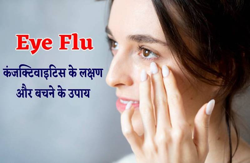 Conjunctivitis Eye Flu : हवा की तरह फैल रहा कंजक्टिवाइटिस, आइ फ्लू से बचने के लिए करें ये उपाय