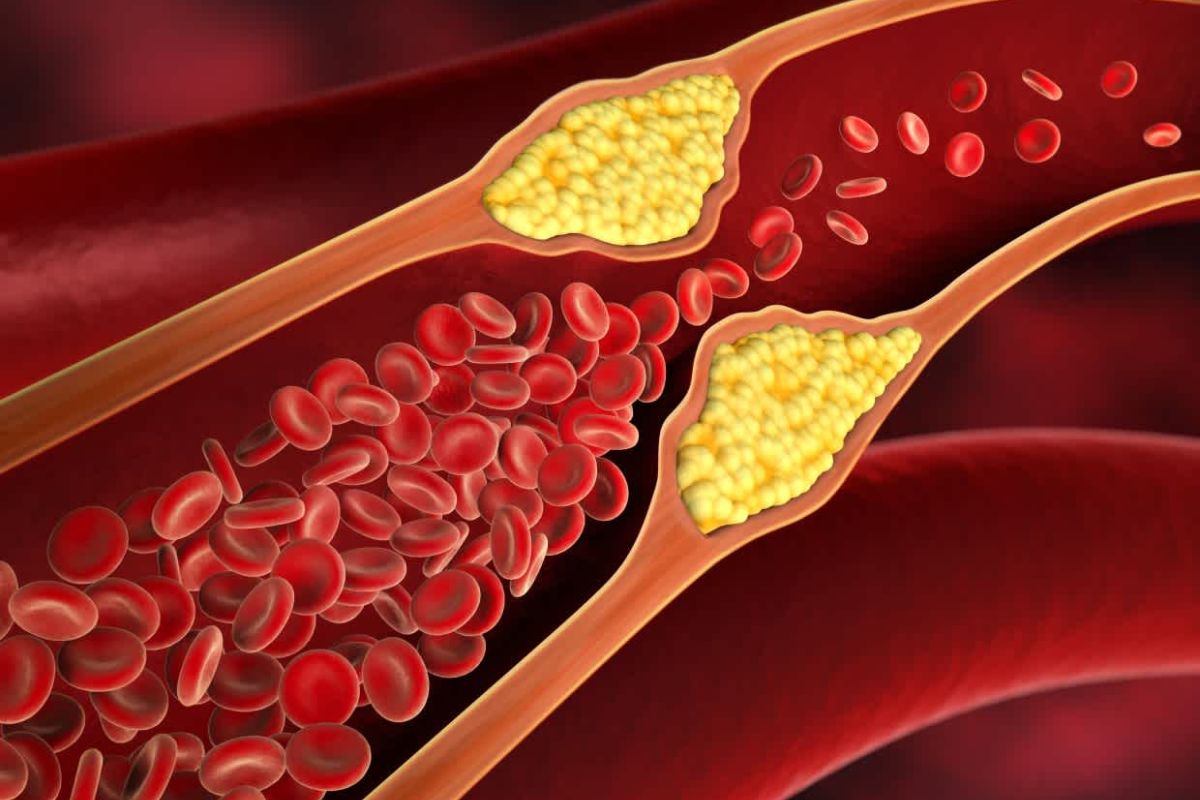 cholesterol_levels.jpg