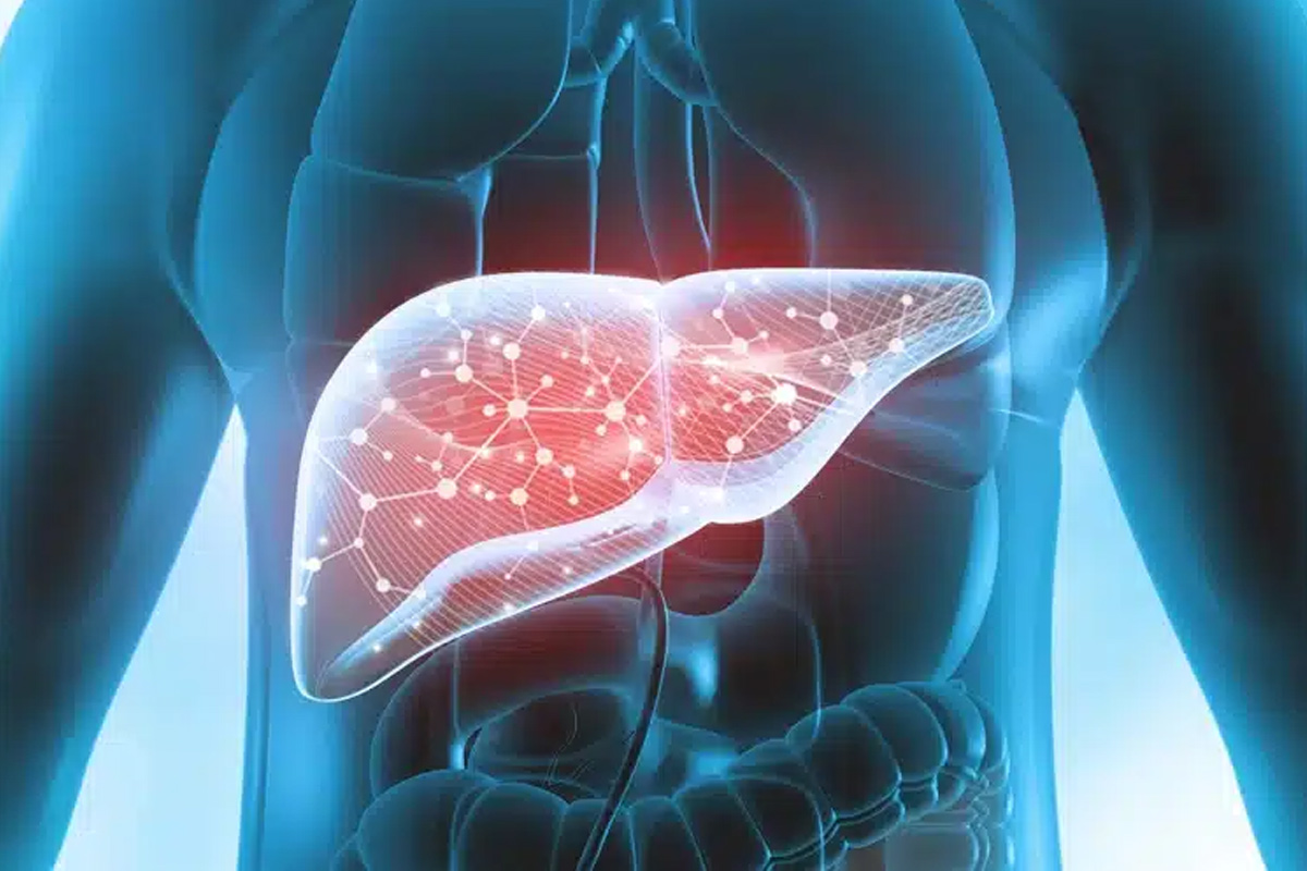 fatty-liver.jpg