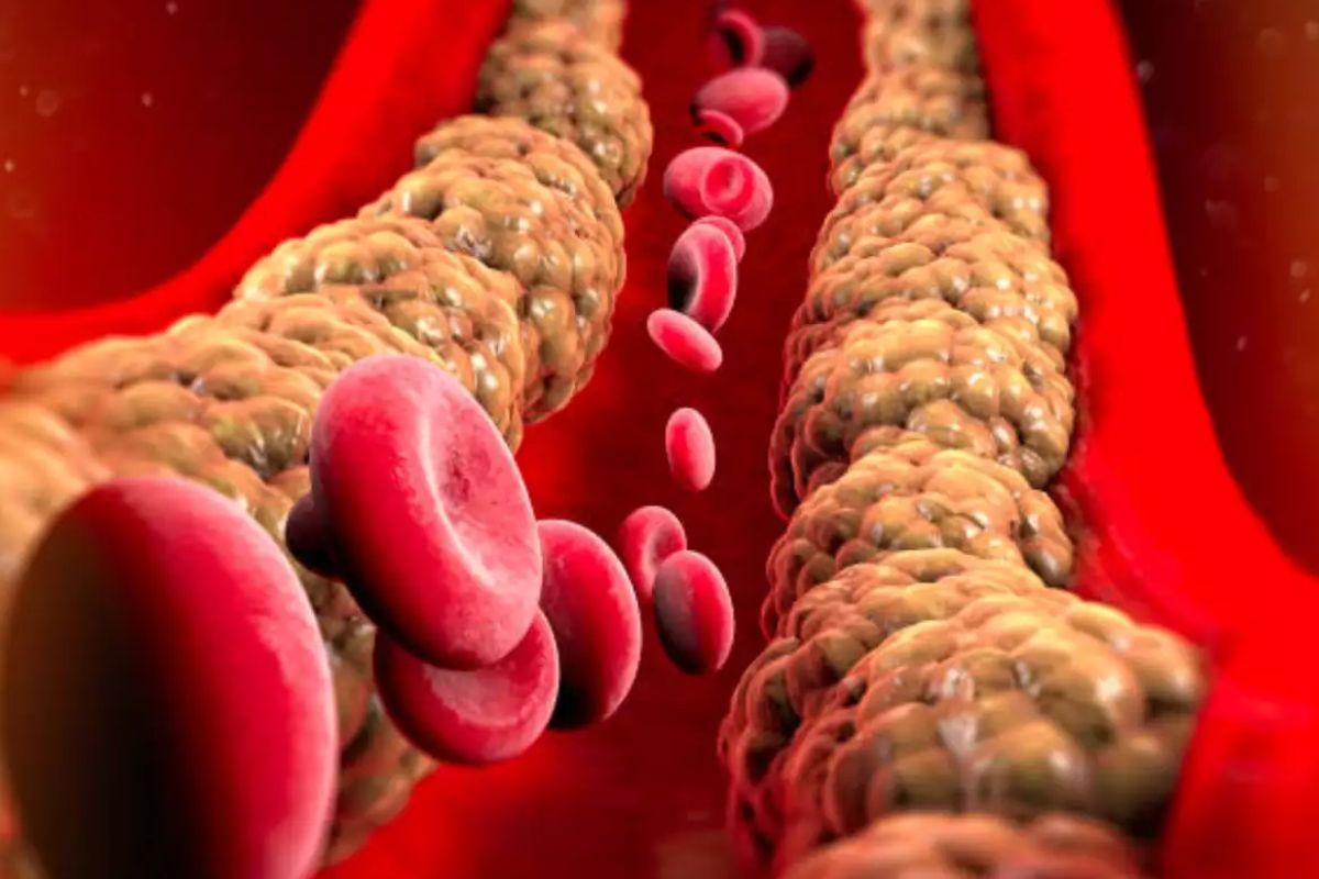 cholesterol.jpg