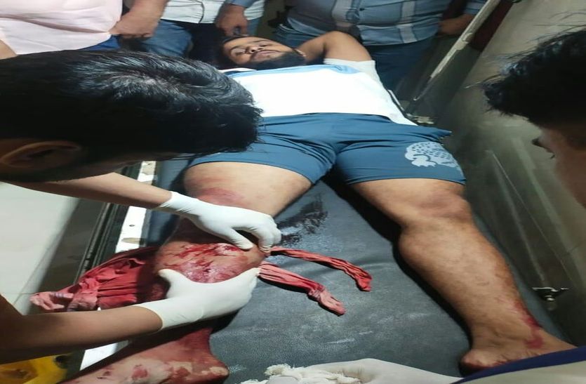 हिस्ट्रीशीटर व पुलिस में फायरिंग, गोली से हिस्ट्रीशीटर घायल