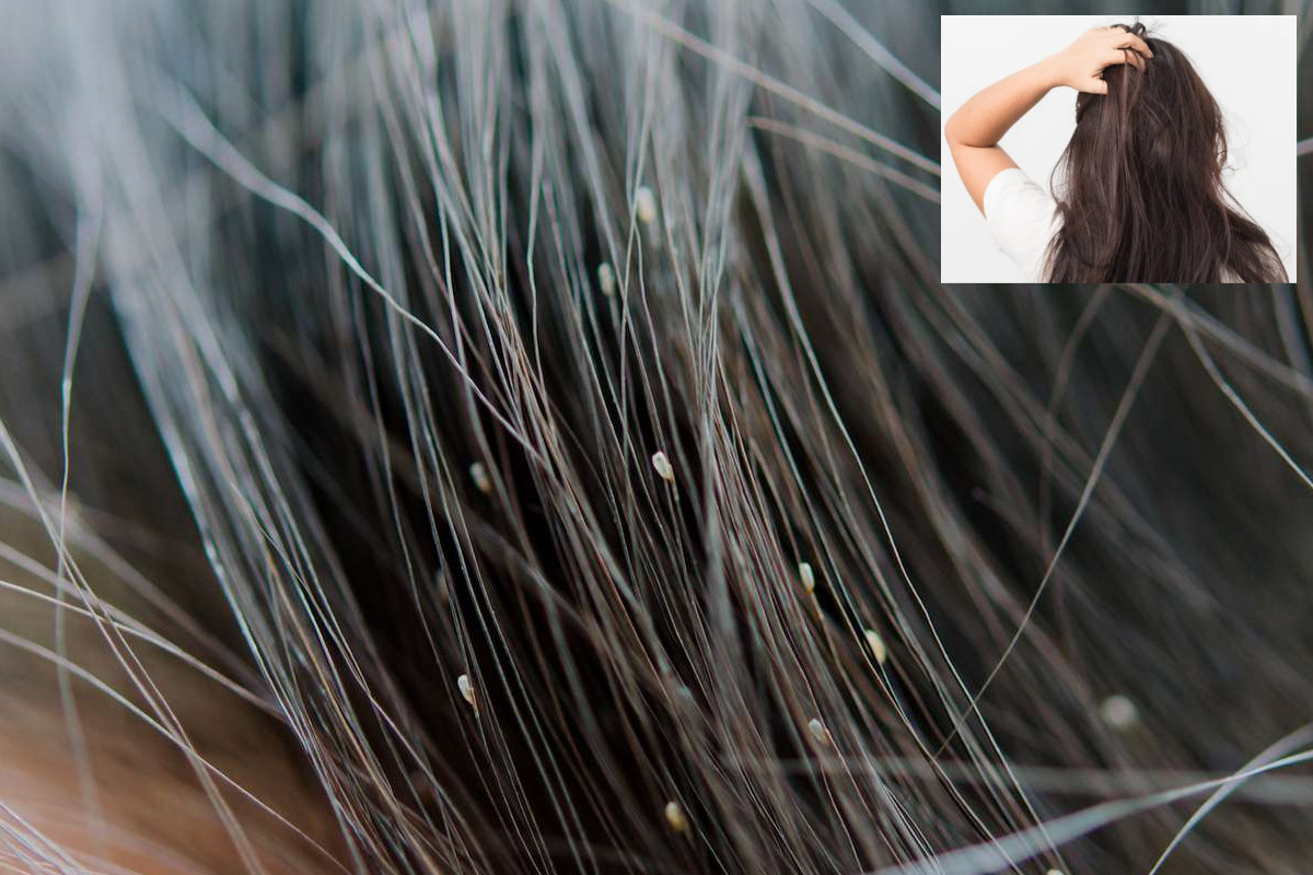 lice_prevention_tips.jpg