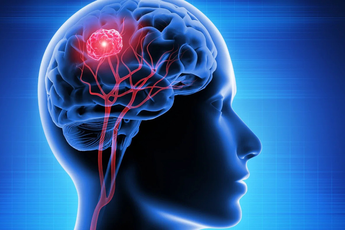 brain_tumor.jpg