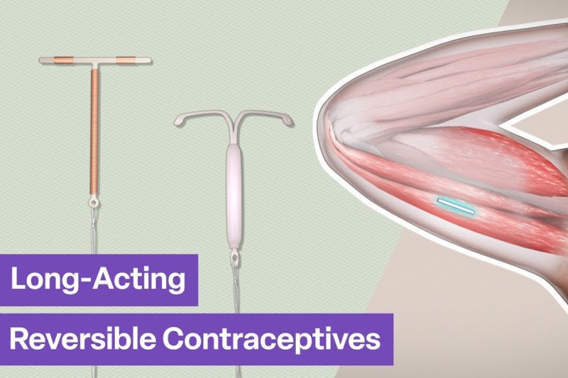 Long-Acting Reversible Contraceptives
