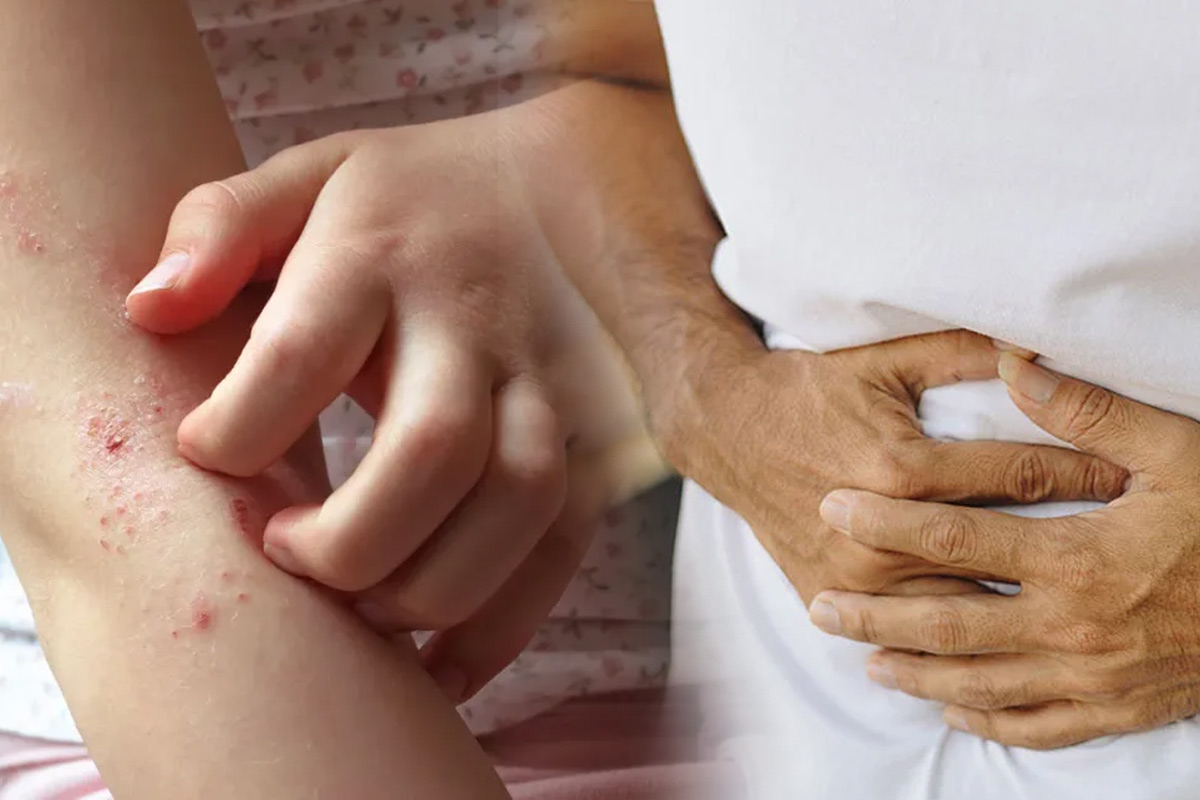 Skin diseases may increase the risk of digestive problems