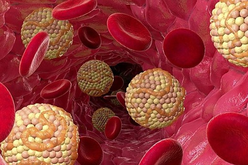 bad-cholesterol.jpg