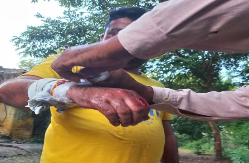 Fatal attack on two members of the rescue team in one and a half month, python attack worsened the forest worker's health, damaged three teeth in his hand