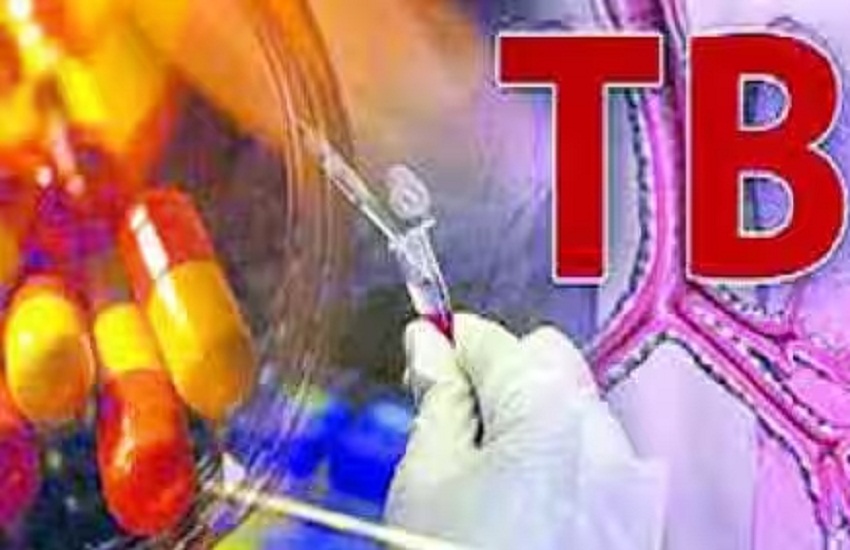 घटने की बजाय लगातार बढ़ रहे टीबी के मरीज, प्रदूषण सबसे बड़ी वजह