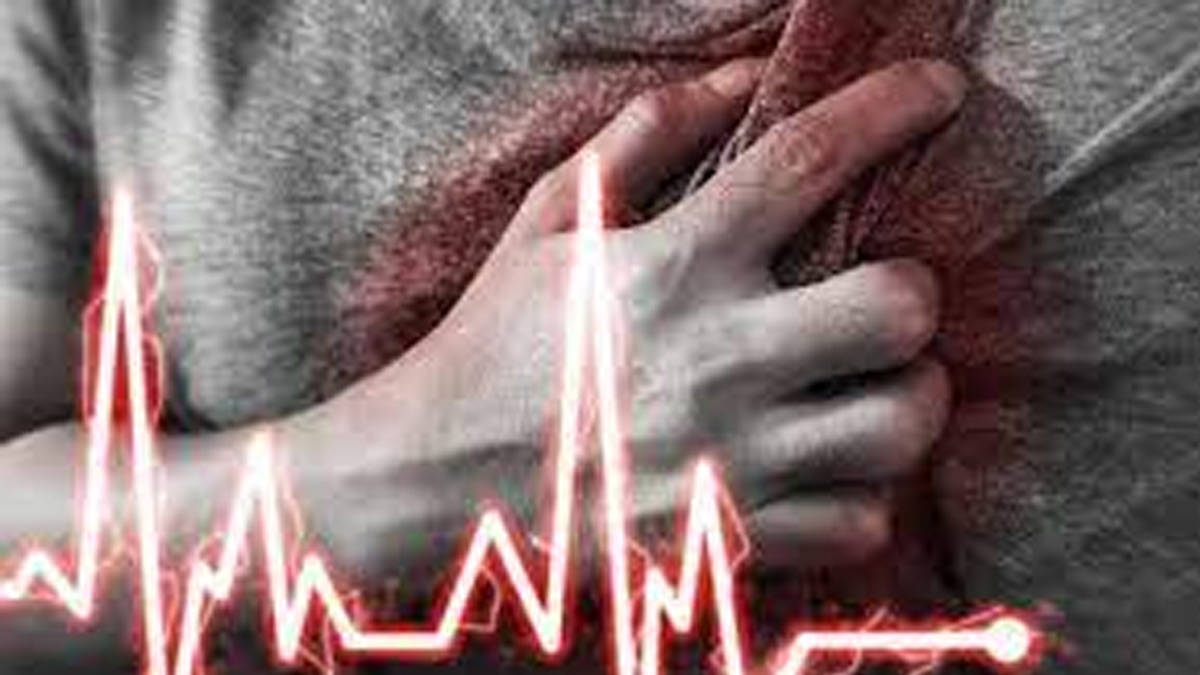 atrial fibrillation