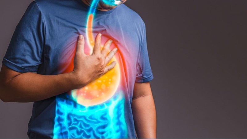 Gastroesophageal reflux disease