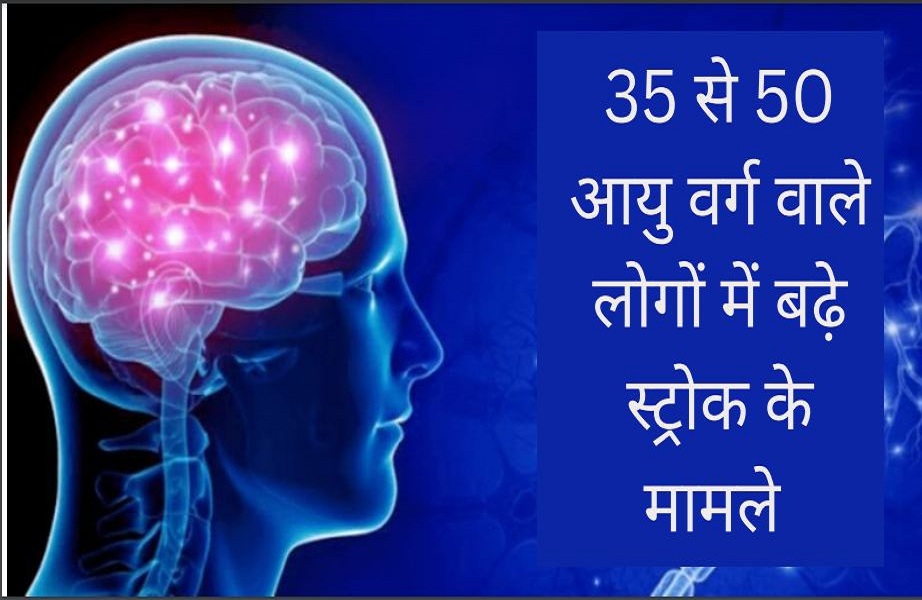 स्ट्रोक के लक्षण कई बार बेहद सामान्य तो कई बार बेहद गंभीर रूप से नजर आते हैं,