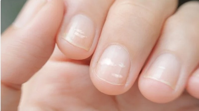 calcium deficiency in the body