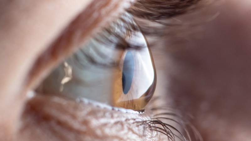 foods that can improve blurry vision