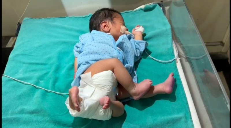 wonderful new born in LLRM Meerut