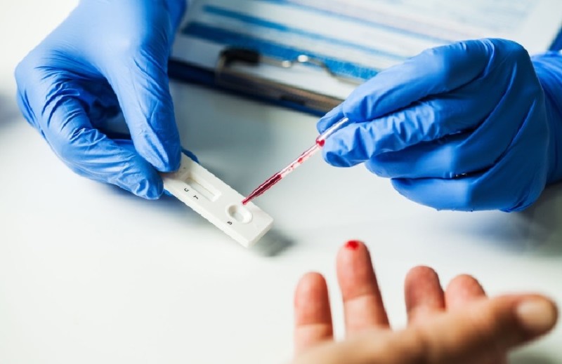 रक्त की थोड़ी सी मात्रा से एक ही समय में एचआईवी और टीबी दोनों का पता लगा सकता है