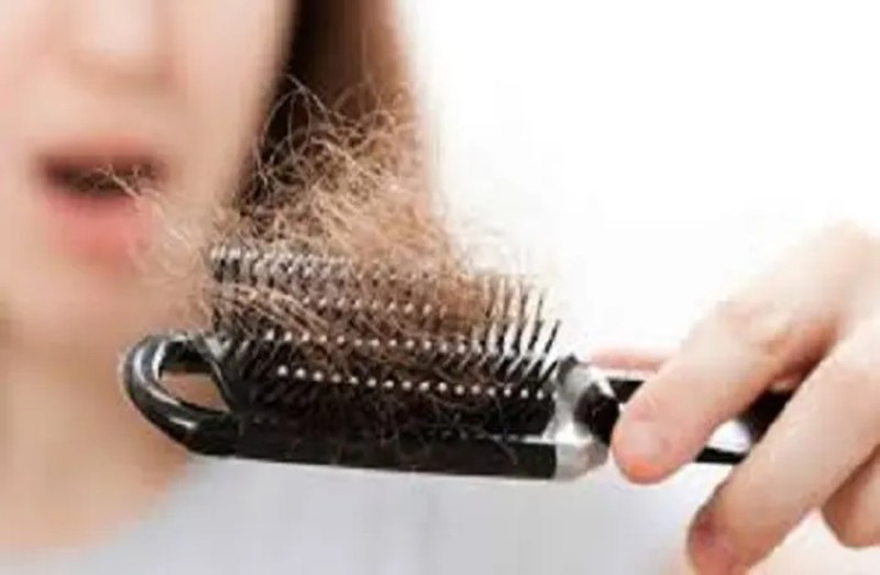 Hair Fall Treatment At SMS Hospital