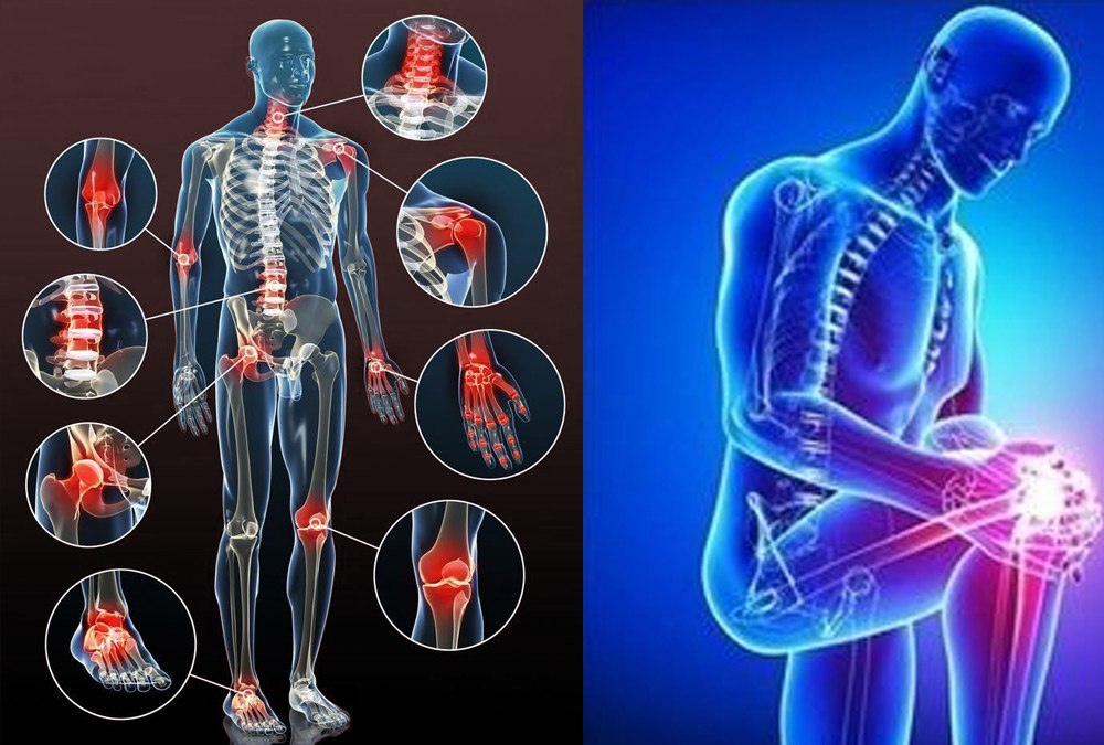 osteoarthritis.jpg