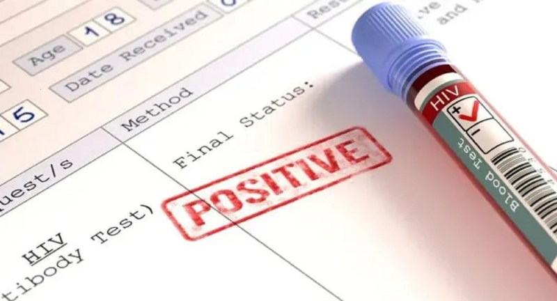 विश्व एड्स दिवस: रेड जोन के दायरे से बाहर नहीं आया हमारा जिला