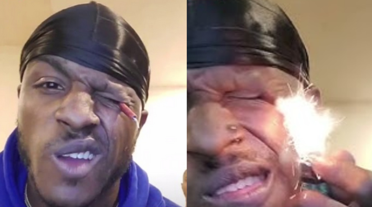 man_burts_firecracker_in_his_eye.jpg
