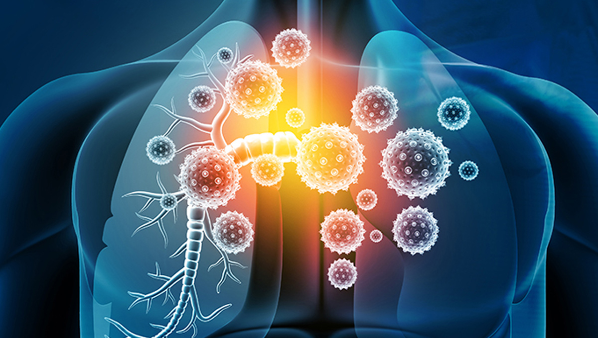 lung-infections.jpg