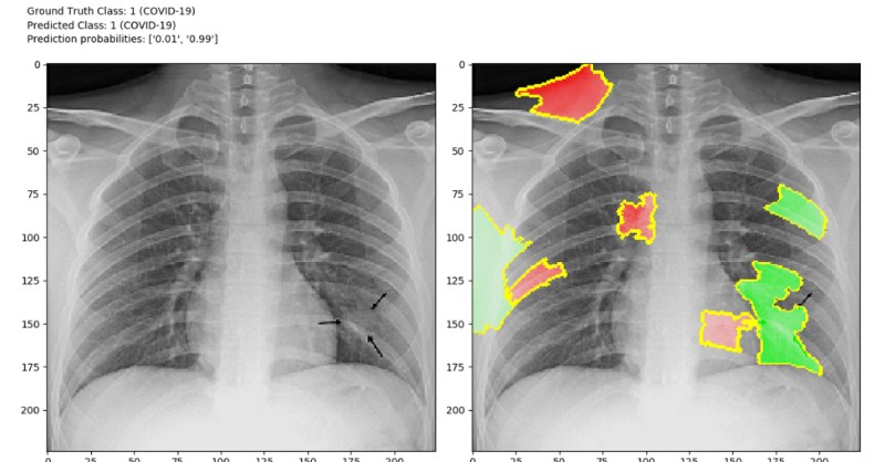 covid-19-from-chest-x-ray.jpg