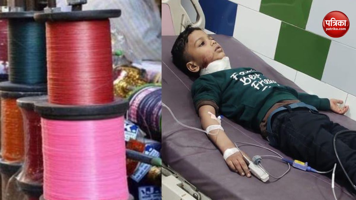 Varanasi Chainiz Manjha Injury