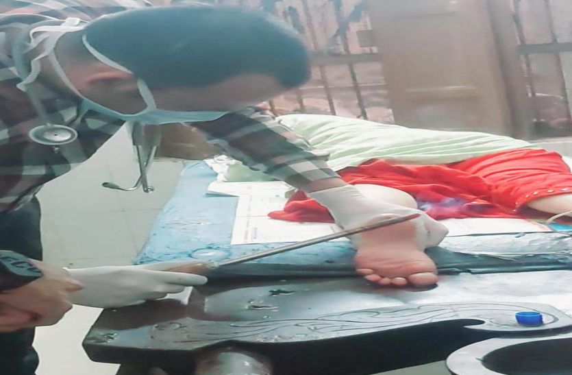 यहां गर्म शलाका जलाती नहीं, दर्द से राहत देती है, जाने वजह
