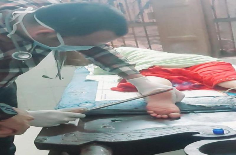 यहां गर्म शलाका जलाती नहीं, दर्द से राहत देती है, जाने वजह