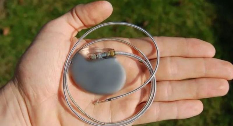 pacemaker_.jpg