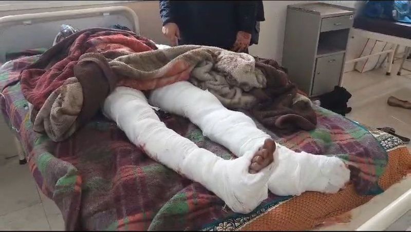 वर्चस्व की लड़ाई में खून बहा, गैंगवार में सलीम उर्फ लंगड़ा का पैर टूटा