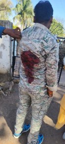 सीएम हेल्पलाइन की शिकायत बंद कराने गई पुलिस पार्टी पर कुल्हाड़ी से हमला