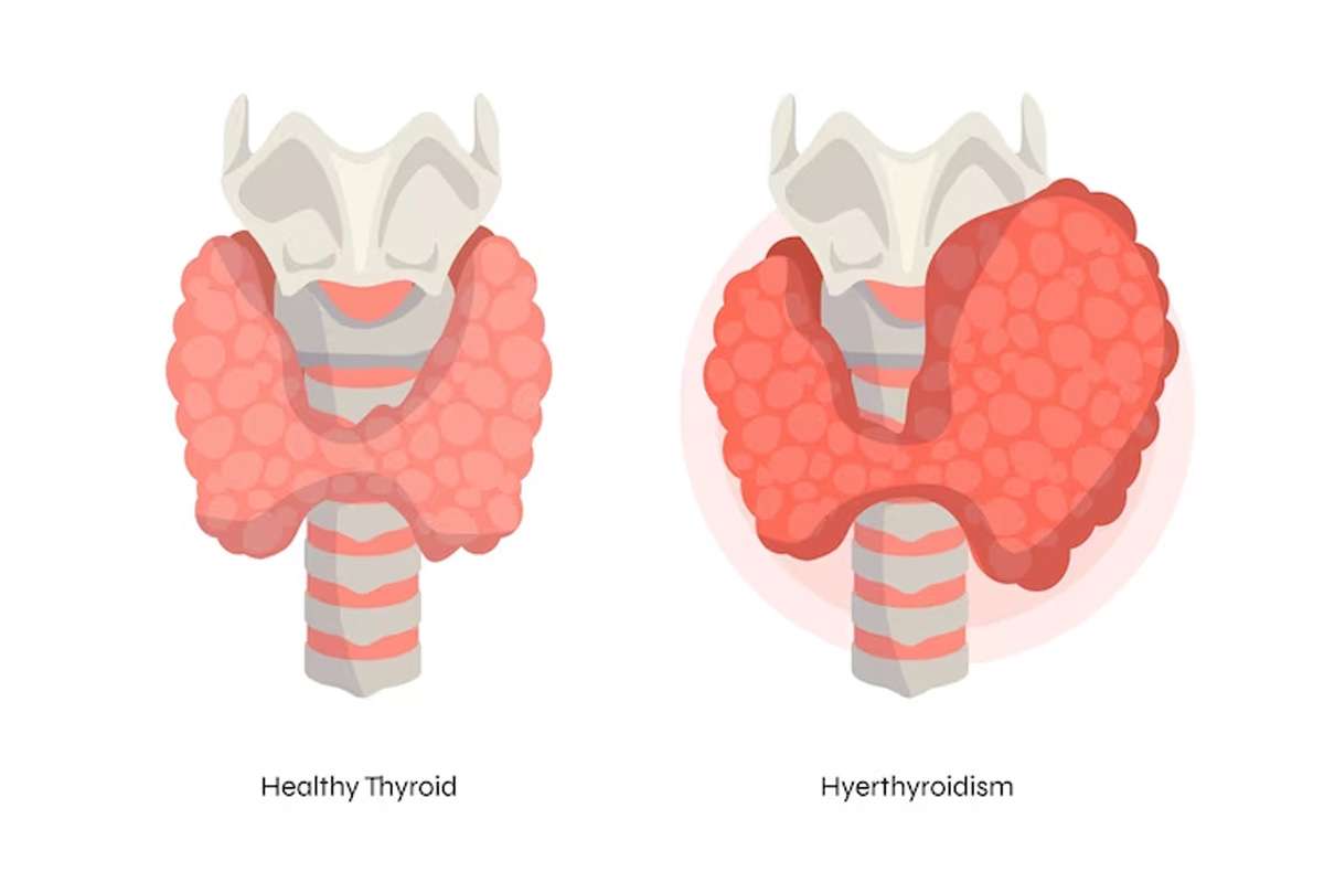 thyroid-gland.jpg