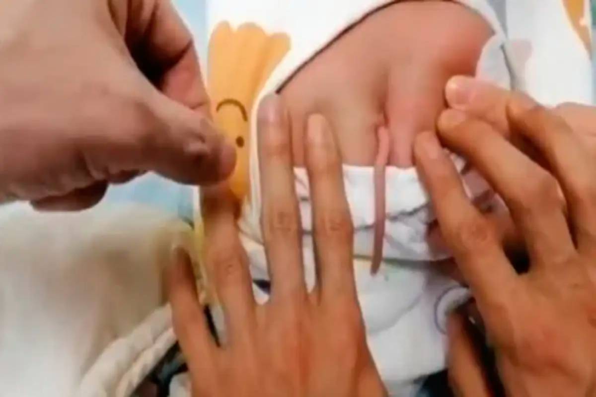 Baby born with tail in china