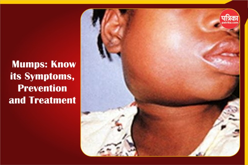 mumps.jpg