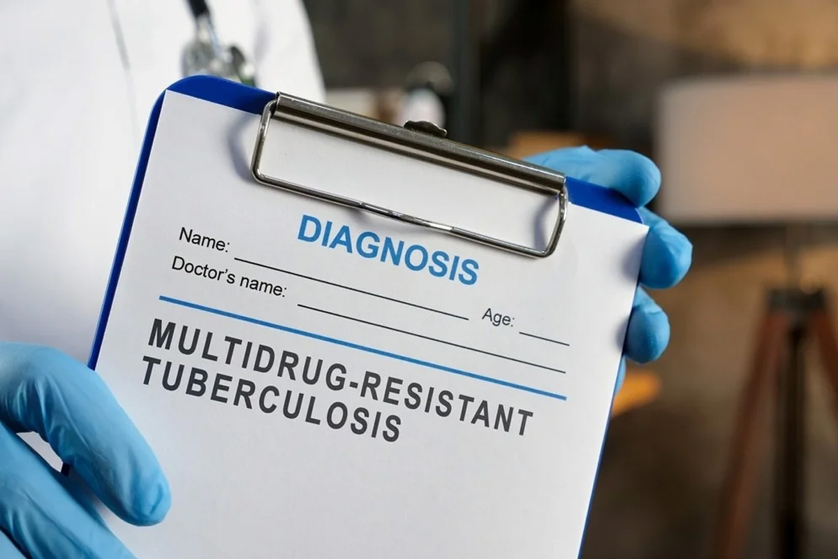 multidrug-resistant-tubercu.jpg