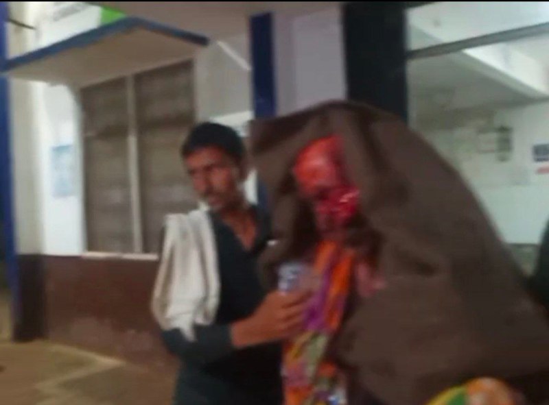 ग्रामीण पर किया तेंदुए ने हमला, गंभीर हालत में ग्वालियर रैफर