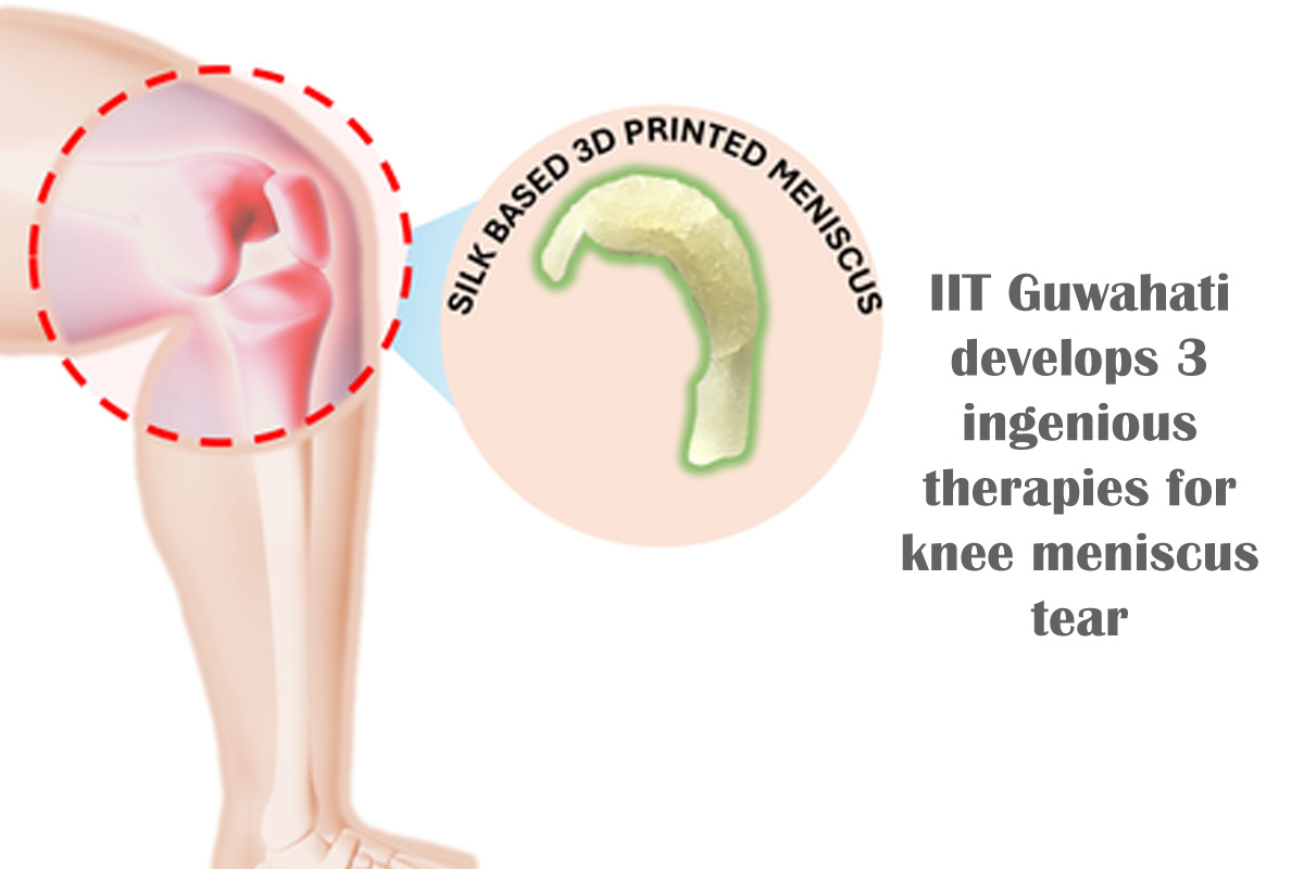 knee-meniscus-tear.jpg