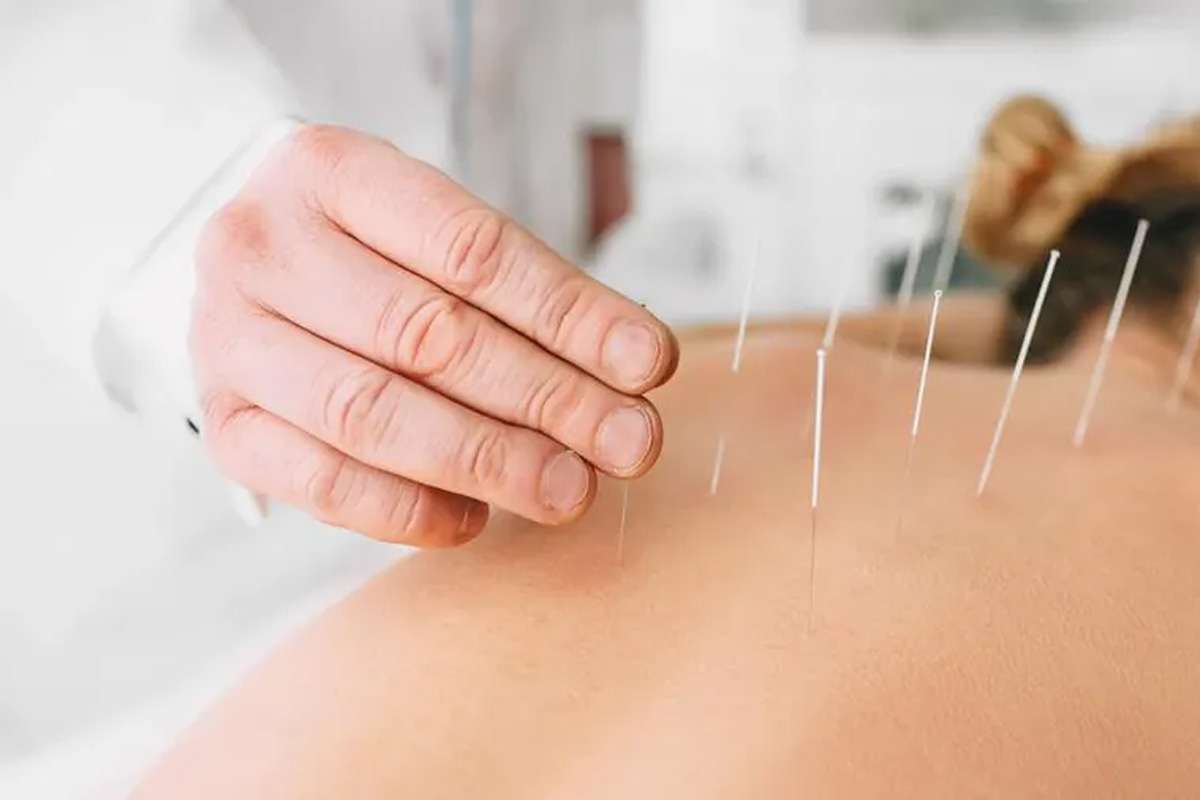 acupuncture-how-it-works.jpg